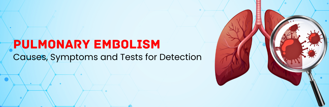 What are the Causes and Symptoms of Pulmonary Embolism with the Tests for Detection?